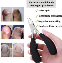 Merkloos Nageltang Voor Harde Teennagels - Manicureset Teennagelknipper - Teennagelschaar - Pedicure Set 9 Merkloos Nageltang Voor Harde Teennagels - Manicureset Teennagelknipper - Teennagelschaar - Pedicure Set -Nagelverzorging Winkel 1196x1200 7