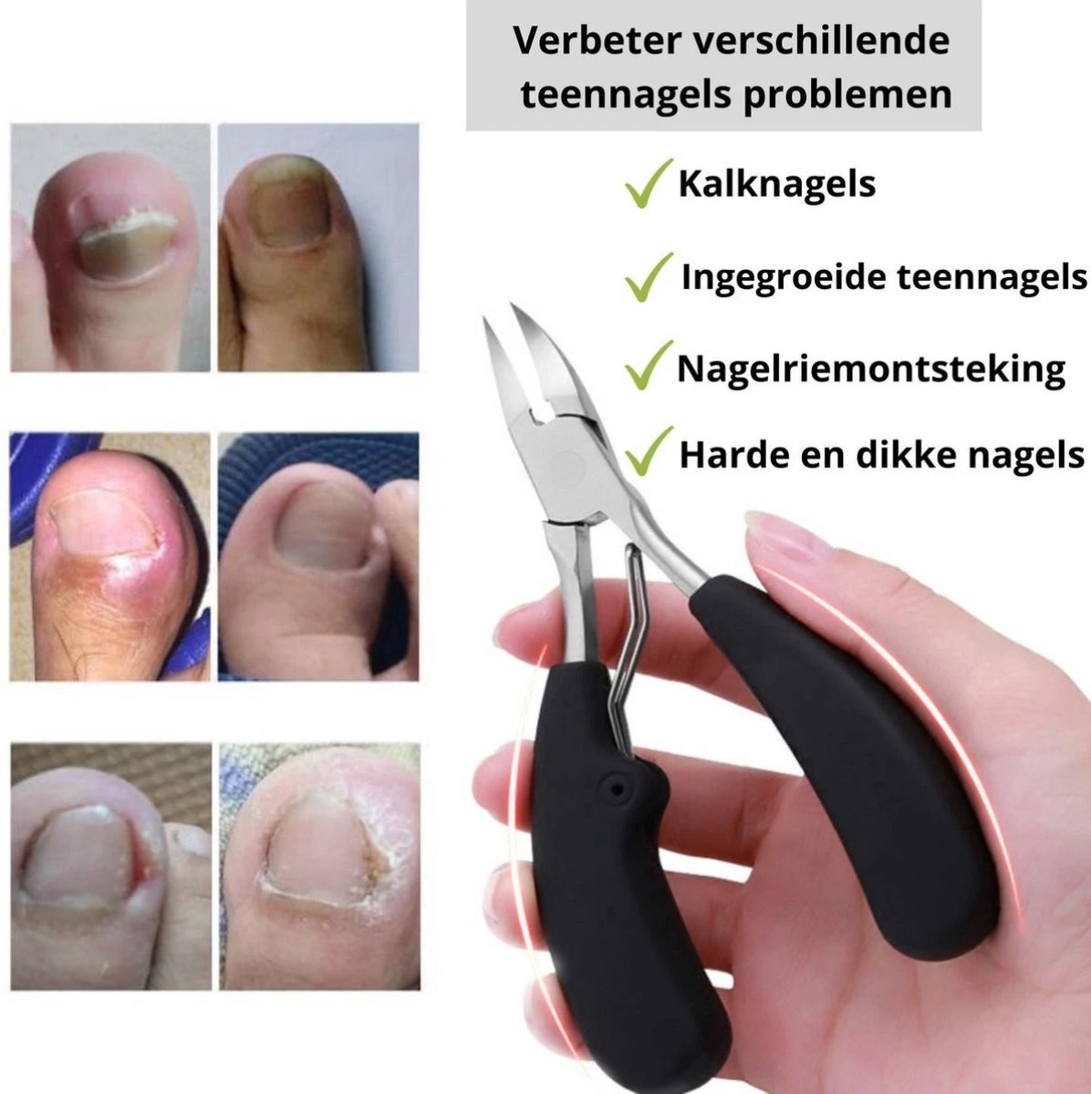 Merkloos Nageltang Voor Harde Teennagels - Manicureset Teennagelknipper - Teennagelschaar - Pedicure Set 3 Merkloos Nageltang Voor Harde Teennagels - Manicureset Teennagelknipper - Teennagelschaar - Pedicure Set - Afbeelding 3