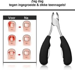 Merkloos Nageltang Met Gebogen Bek + Vijl - Nagelknipper Set - Pedicure Set -Nagelverzorging Winkel 1200x1117 8