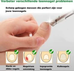 Merkloos Nageltang Met Gebogen Bek + Vijl - Nagelknipper Set - Pedicure Set -Nagelverzorging Winkel 1200x1153 5